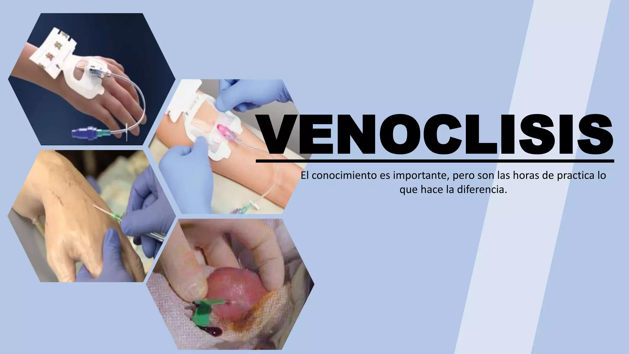 CURSO: Venoclisis y Valoración Integral de la Vía Periférica